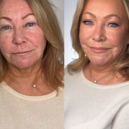  #motherofthebride #matureskin